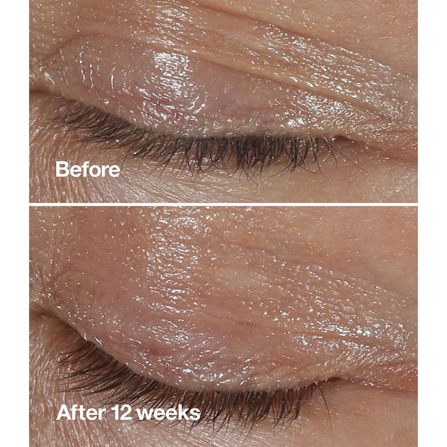 Clinique Smart Clinical Repairwear Eye Cream 15ML Göz Kremi